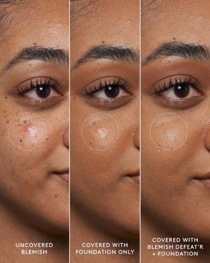 Fenty Skin Blemish Defeat’r BHA Spot-Targeting Gel (R510) Item | Buy Fenty Skin Blemish Defeat’r BHA Spot-Targeting Gel (R510) | SPOP Enterprise Global