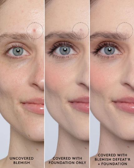 Fenty Skin Blemish Defeat’r BHA Spot-Targeting Gel (R510) Item | Buy Fenty Skin Blemish Defeat’r BHA Spot-Targeting Gel (R510) | SPOP Enterprise Global